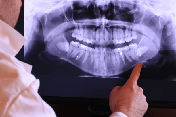 Best Emergency Tooth Extraction  in Carbondale, KS