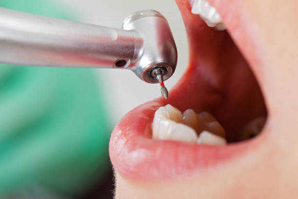 Best Cracked Tooth Emergency Dentist  in Carbondale, KS